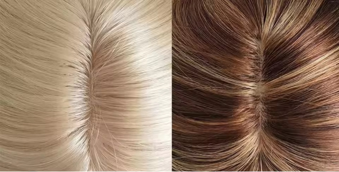 Hair Loss Women’s Topper 14x15cm